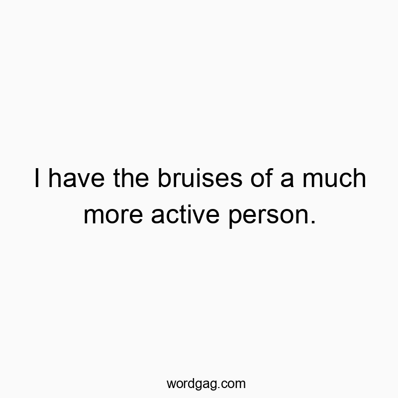 I have the bruises of a much more active person.